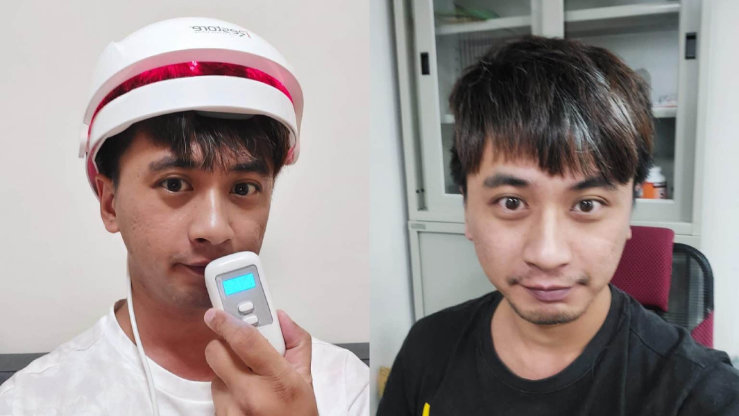 【使用見證文章】iRestore愛麗朵爾雷射生髮帽推薦/使用三個月心得效果/為什麼會掉髮?幫您解決雄性禿和遺傳性落髮的困擾